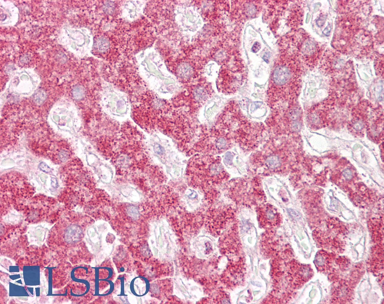 IHC-plus™ Polyclonal Rabbit anti-Human RELA / NFKB p65 Antibody (IHC, WB)
