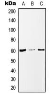 MAZ Antibody (Internal)