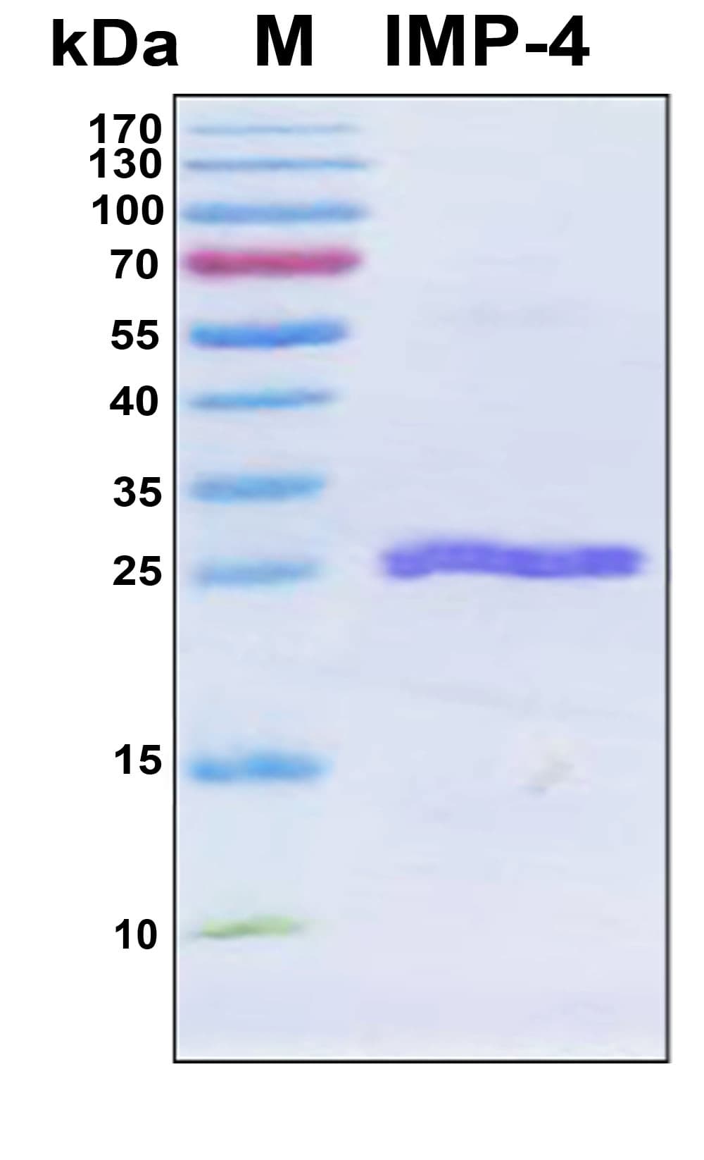 Klebsiella pneumoniae Beta-lactamase IMP-4 Protein (Recombinant 6His, N-terminus)