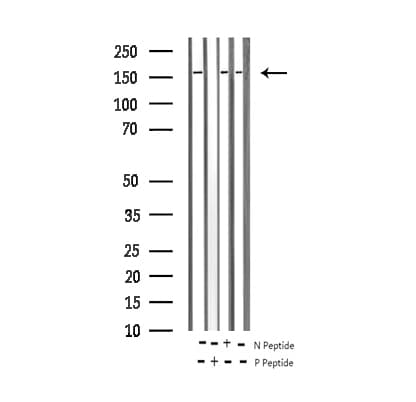 Polyclonal Rabbit anti-Human EGFR Antibody (phospho-Tyr1110, IF, WB)