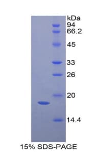 Mouse GKN1 / Gastrokine 1 Protein (Recombinant His)