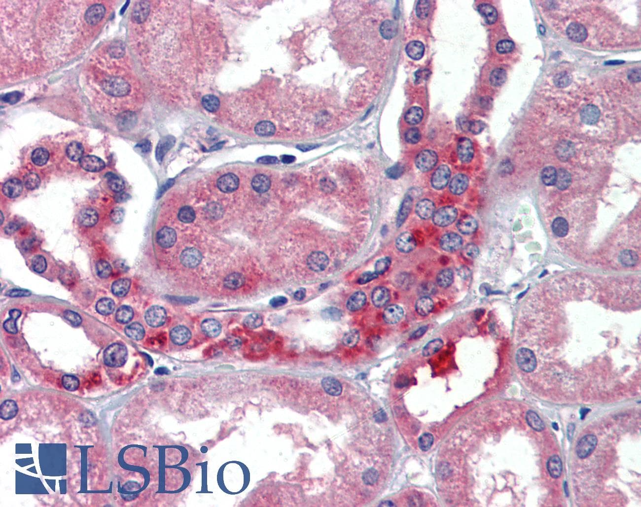 IHC-plus™ RNH1 Antibody (clone AT1H23)