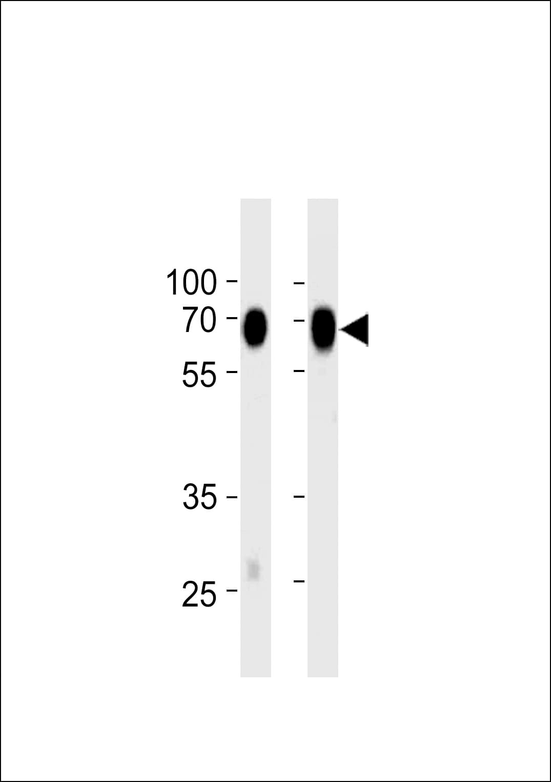 NT5E / eNT / CD73 Antibody (clone 974CT7.5.3)