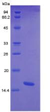Human CTGF Protein (Recombinant His, N-Terminal)