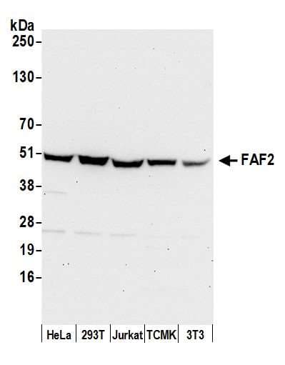 FAF2 / ETEA Antibody (aa395-445)