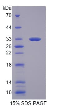 Rat NOX1 Protein (Recombinant His-T7)