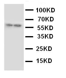 Polyclonal Rabbit anti-Human GABRA1 Antibody (aa440-456, IHC, WB)