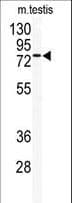 Polyclonal Rabbit anti-Human TLK2 Antibody (aa141-171, WB)