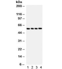 Polyclonal Rabbit anti-Human Pyruvate Kinase Antibody (IHC, WB)