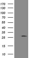 UBE2S / E2 EPF Antibody (clone OTI4G2)