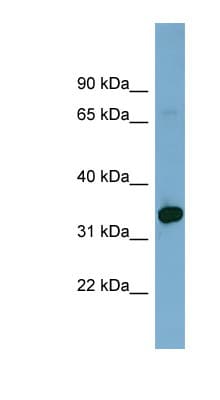HOXD12 Antibody (C-Terminus)