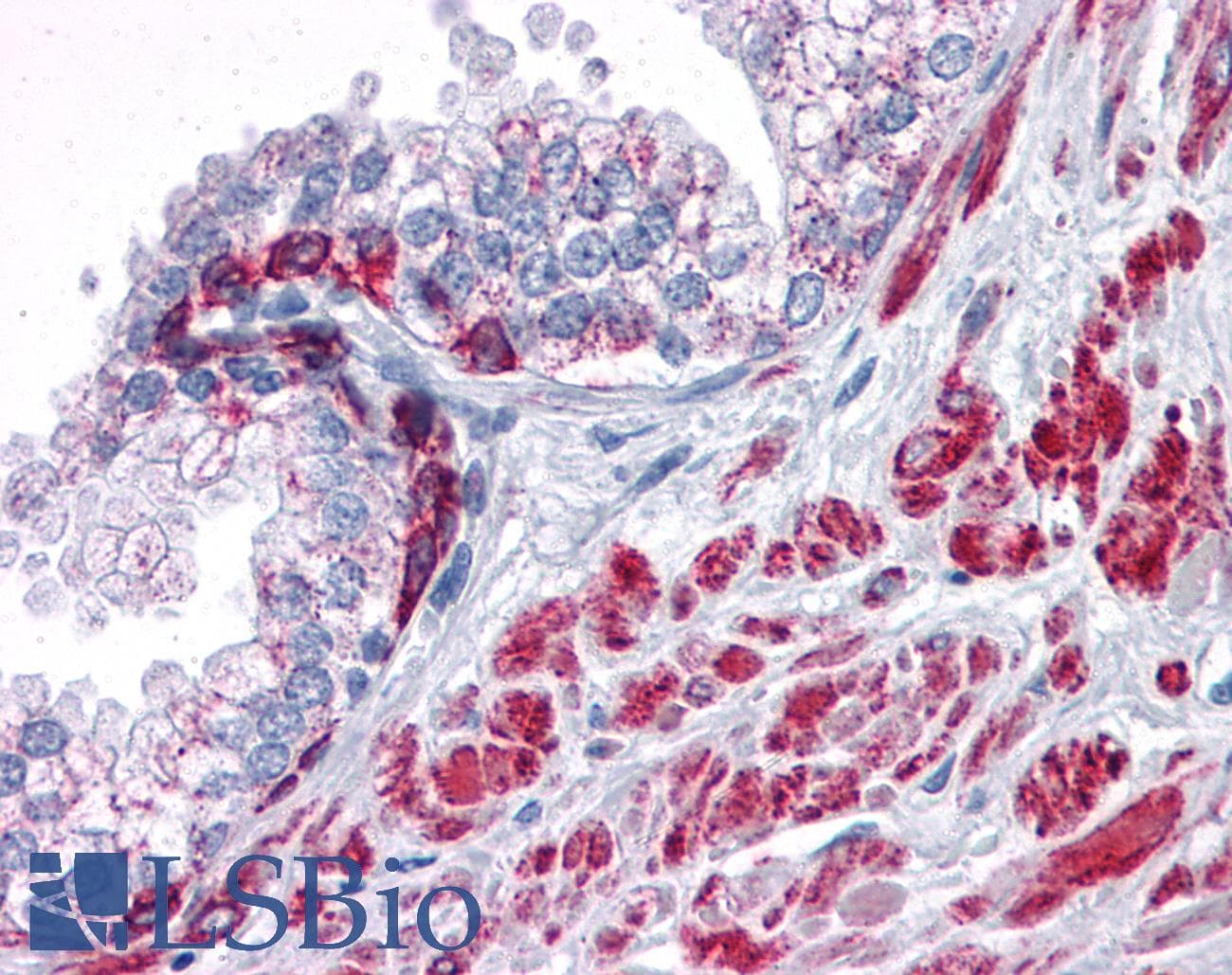 IHC-plus™ ANKRD54 / LIAR Antibody