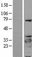 YWHAB / 14-3-3 Beta Protein (Over-Expression Lysate Myc-DDK (Flag))