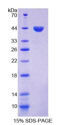 Human FSH Protein (Recombinant His-GST)