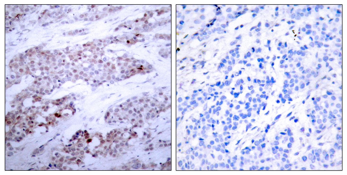 ATF4 Antibody (phospho-Ser245)