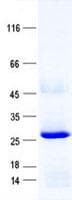 Human F8 / FVIII / Factor VIII Protein (Recombinant His, N-Terminal)