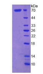 Mouse ASPN / Asporin Protein (Recombinant His-GST, N-terminus)