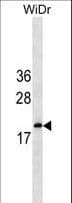 IFNA5 / Interferon Alpha 5 Antibody (aa163-189)