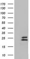 EFNA2 / Ephrin A2 Antibody (clone OTI1C9)