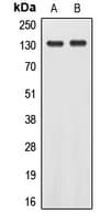 EPHA2 / EPH Receptor A2 Antibody (Internal)