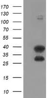 UBE2J1 Antibody (clone OTI1H10)