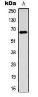 ER Alpha / Estrogen Receptor Antibody (phospho-Ser106)