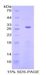 Mouse SGK3 Protein (Recombinant His-T7)