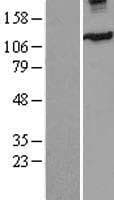 Human KIF11 / EG5 Protein (Over-Expression Lysate Myc-DDK (Flag))