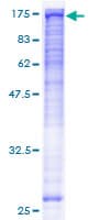 Human BUB1B / BubR1 Protein (Recombinant GST)