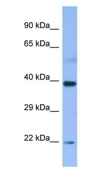 MBIP Antibody (aa114-163)