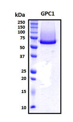 Human GPC1 / Glypican Protein (Recombinant His, N-Terminal)