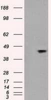 Monoclonal Mouse anti-Human MAPK8 / JNK1 Antibody (clone OTI2F10, WB)
