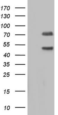 Monoclonal Mouse anti-Human CAPN5 / Calpain 5 Antibody (clone OTI8F10, aa274-578, WB)