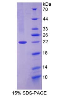 Mouse CNTF Protein (Recombinant His)