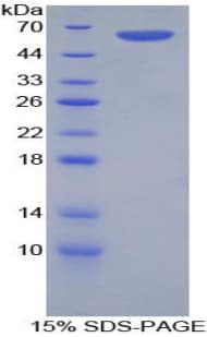 Rat FRA-1 / FOSL1 Protein (Recombinant His-GST)