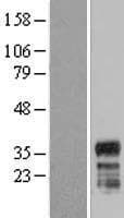 FAM110A Protein (Over-Expression Lysate Myc-DDK (Flag))