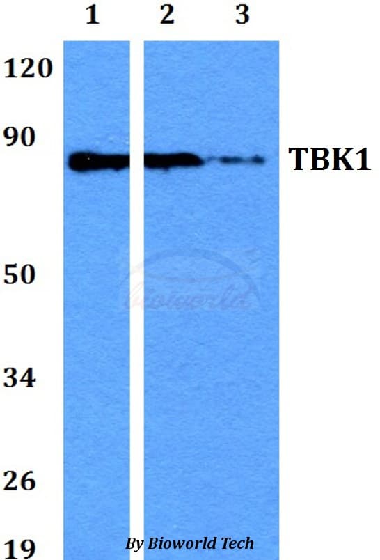 NAK / TBK1 Antibody