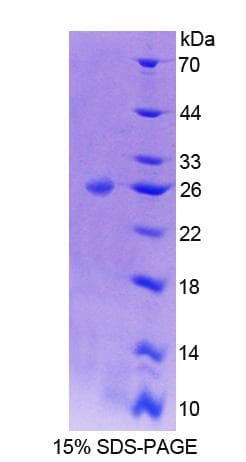 Mouse ADD1 / Adducin Alpha Protein (Recombinant His-T7)