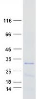 Human TDRP Protein (Recombinant Myc-DDK (Flag))
