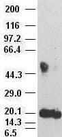IL6 / Interleukin 6 Antibody (clone OTI3G9)