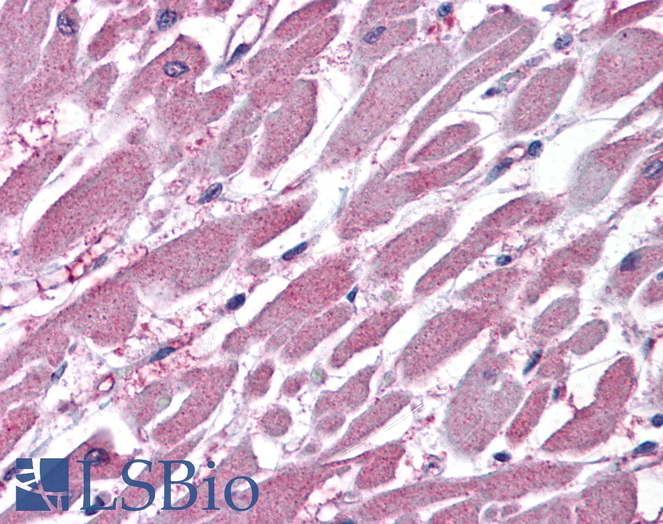 IHC-plus™ Polyclonal Goat anti-Human PPP2R1A Antibody (aa576-589, IHC, WB)