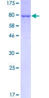 Human GPT / Alanine Transaminase Protein (Recombinant GST)