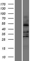 Human ALDH3A2 Protein (Over-Expression Lysate Myc-DDK (Flag))