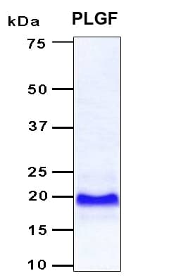 Human PGF / PLGF Protein (Recombinant 6His, N-terminus)