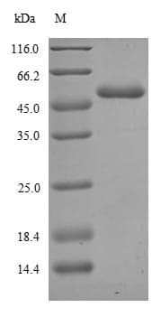Human ER Alpha / Estrogen Receptor Protein (Recombinant 6His, N-terminus)