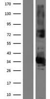 ABHD17B / FAM108B1 Protein (Over-Expression Lysate Myc-DDK (Flag))
