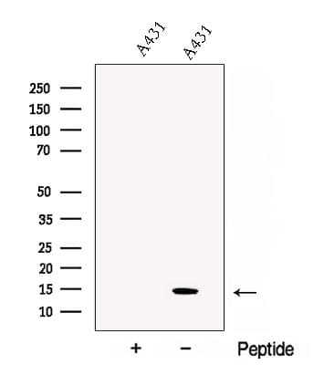 CHCHD10 Antibody