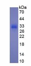 Human Procollagen III N-Terminal Propeptide Protein (Recombinant His, N-Terminal)