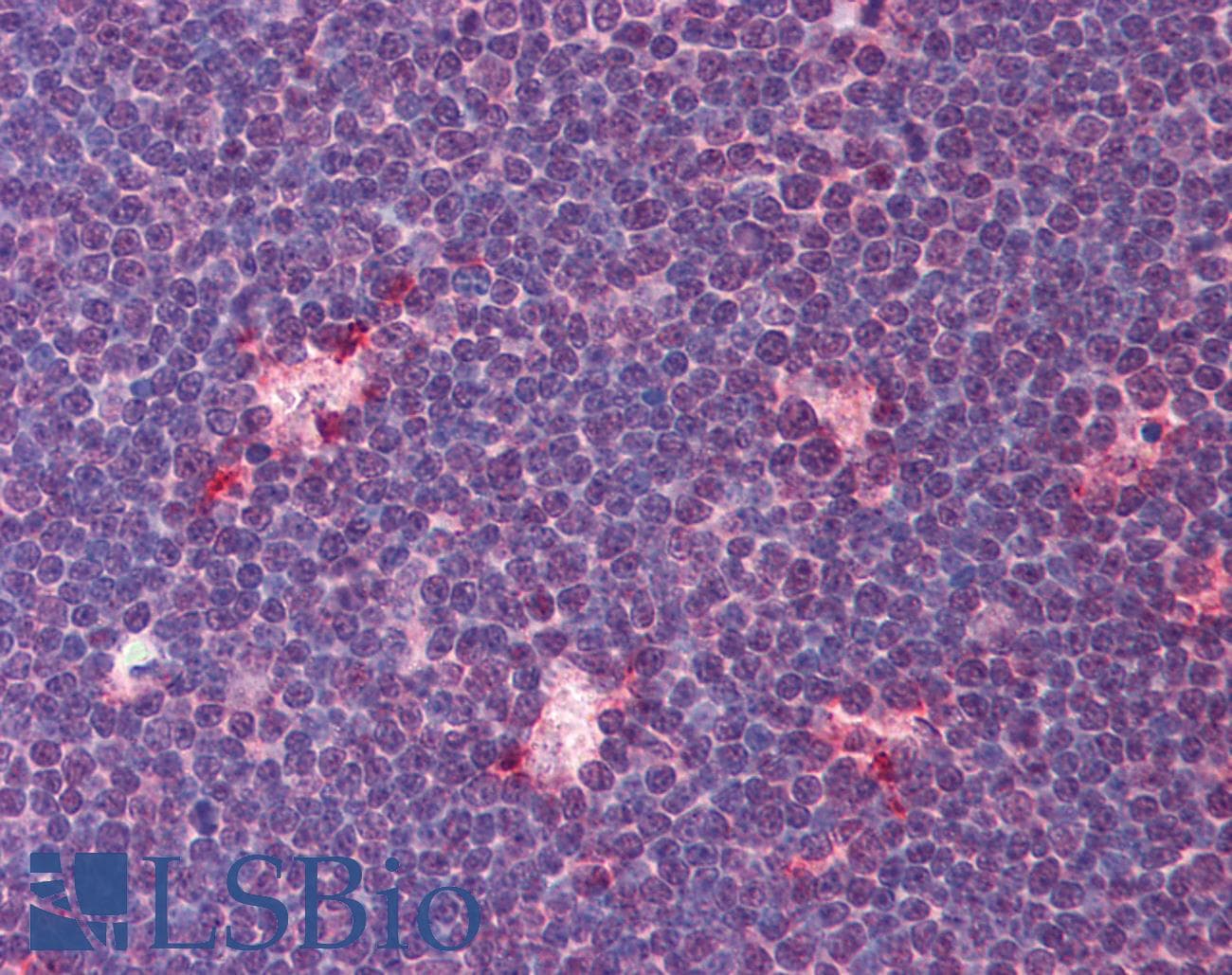 IHC-plus™ Polyclonal Rabbit anti-Human TIMD4 / TIM4 / TIM-4 Antibody (IHC, WB)