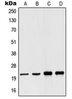 Polyclonal Rabbit anti-Human NDUFB10 Antibody (Internal, WB)